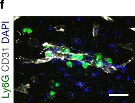 Detection of Mouse Human/Mouse/Rat CD31/PECAM-1 Antibody by Immunohistochemistry