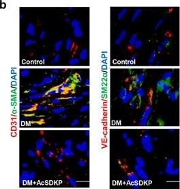 Detection of Mouse CD31/PECAM-1 by Immunocytochemistry/Immunofluorescence