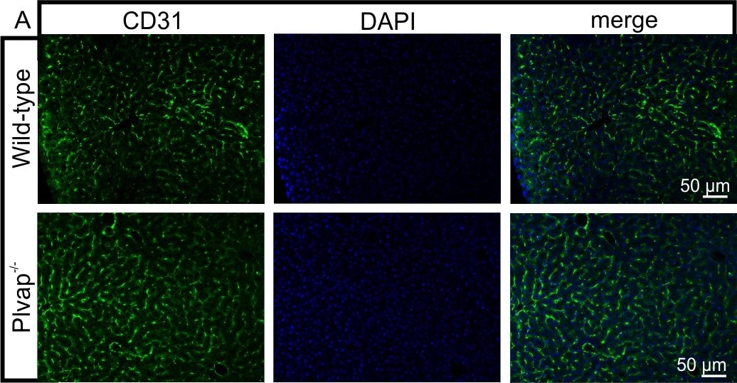 Detection of Mouse CD31/PECAM-1 by Immunocytochemistry/Immunofluorescence