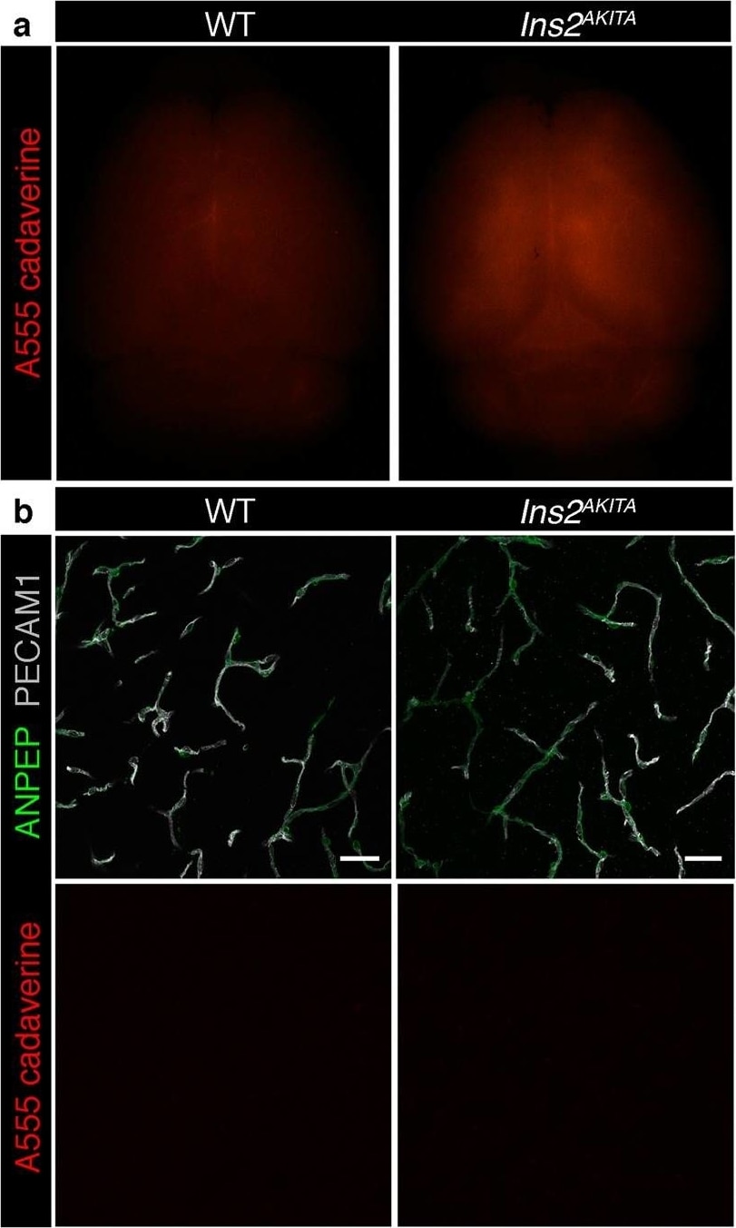 Detection of Mouse CD31/PECAM-1 by Immunohistochemistry