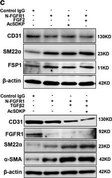Detection of Human CD31/PECAM-1 by Western Blot