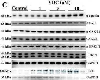Detection of Slit3 by Western Blot