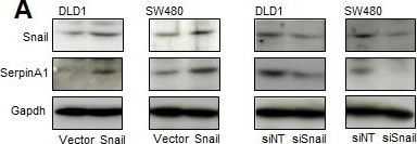 Detection of Human Snail by Western Blot