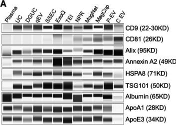 Detection of Apolipoprotein A-I by Western Blot