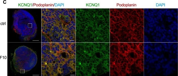 Detection of Podoplanin by Immunohistochemistry