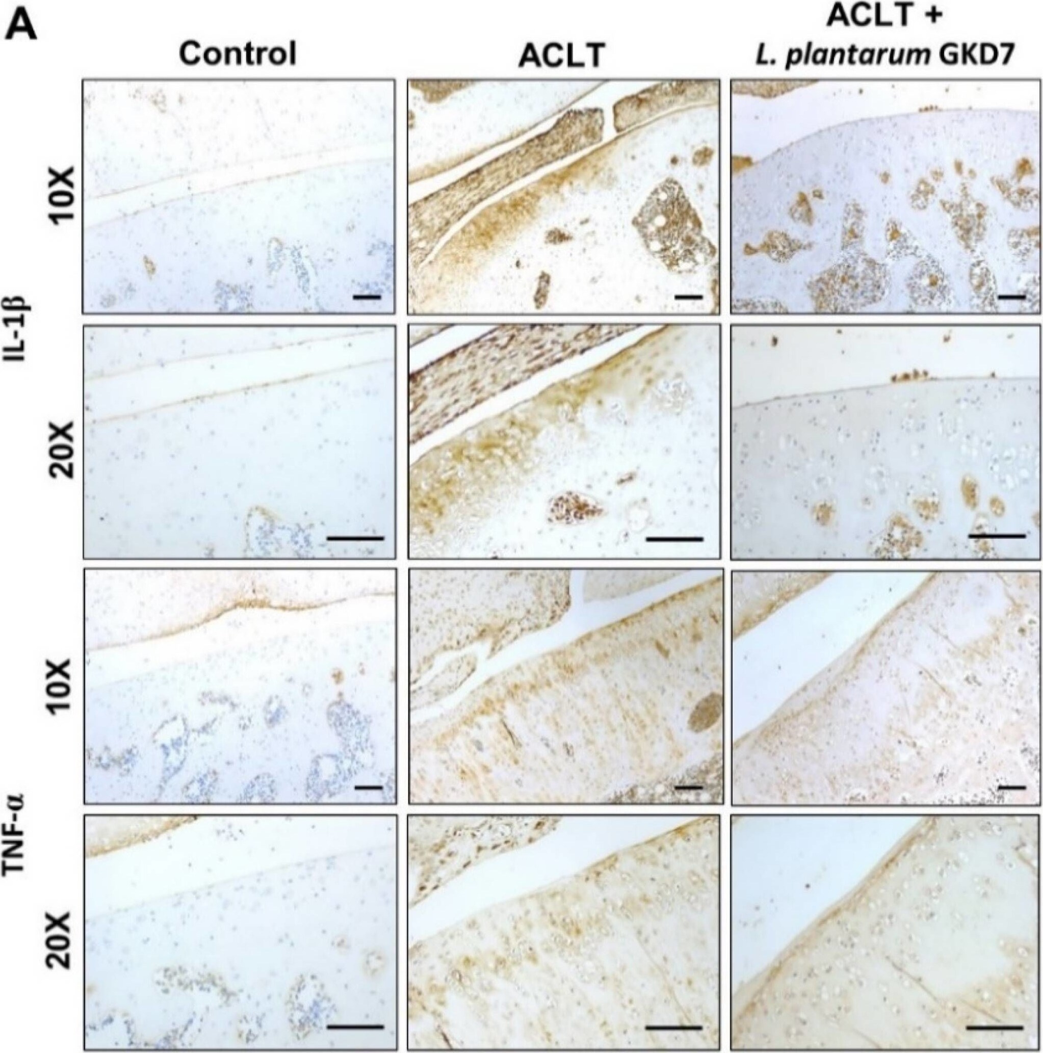 Detection of IL-1 beta /IL-1F2 by Immunohistochemistry