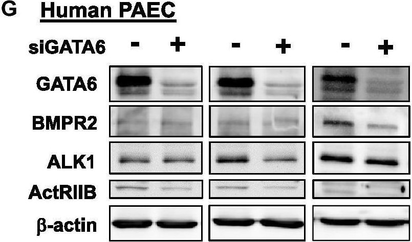 Detection of Human ALK-1 by Western Blot