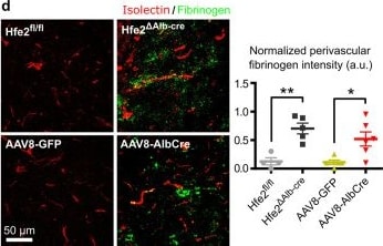 Detection of RGM-C/Hemojuvelin by Immunohistochemistry