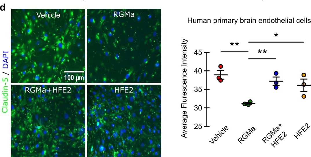 Detection of RGM-C/Hemojuvelin by Immunohistochemistry