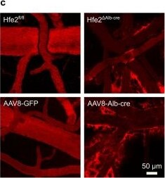 Detection of RGM-C/Hemojuvelin by Immunohistochemistry