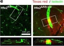 Detection of RGM-C/Hemojuvelin by Immunohistochemistry