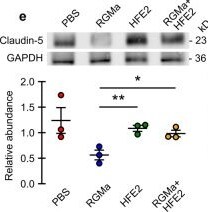Detection of RGM-C/Hemojuvelin by Western Blot