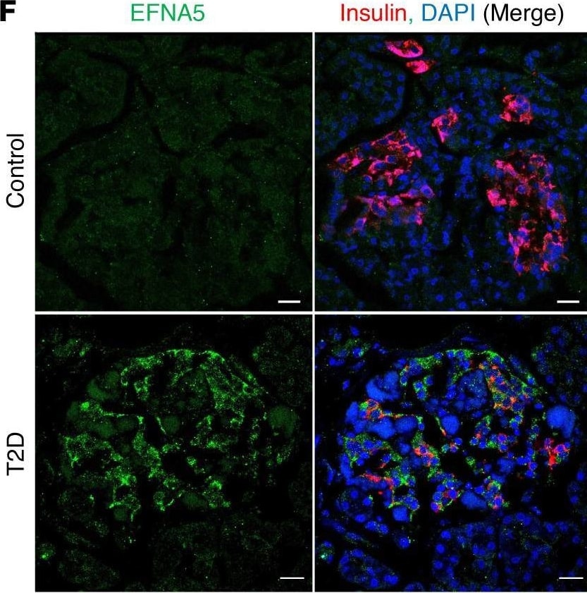 Detection of Ephrin-A5 by Immunohistochemistry