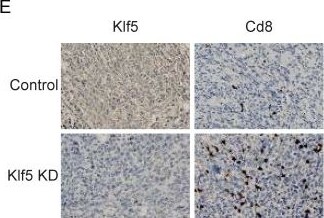 Detection of KLF5 by Immunohistochemistry