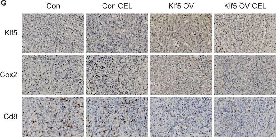 Detection of KLF5 by Immunohistochemistry