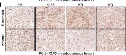 Detection of KLF5 by Immunohistochemistry