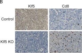 Detection of KLF5 by Immunohistochemistry