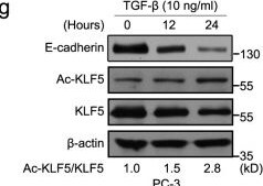 Detection of KLF5 by Western Blot