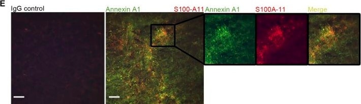 Detection of Annexin A1 by Immunohistochemistry