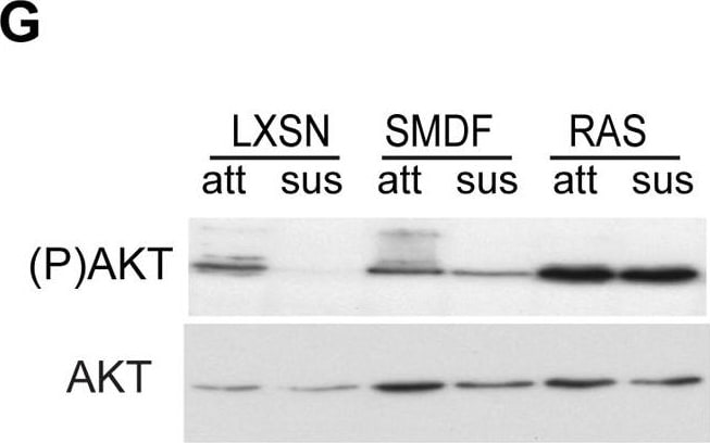 Detection of Neuregulin-1 Isoform SMDF by Western Blot