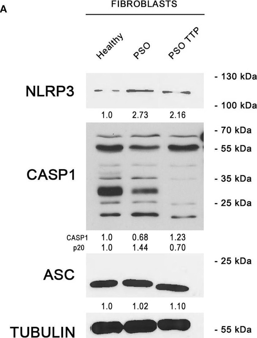 Detection of ASC by Western Blot