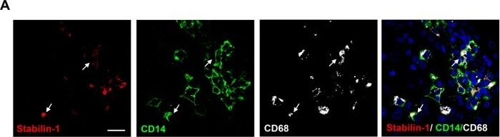 Detection of Stabilin-1 by Immunohistochemistry