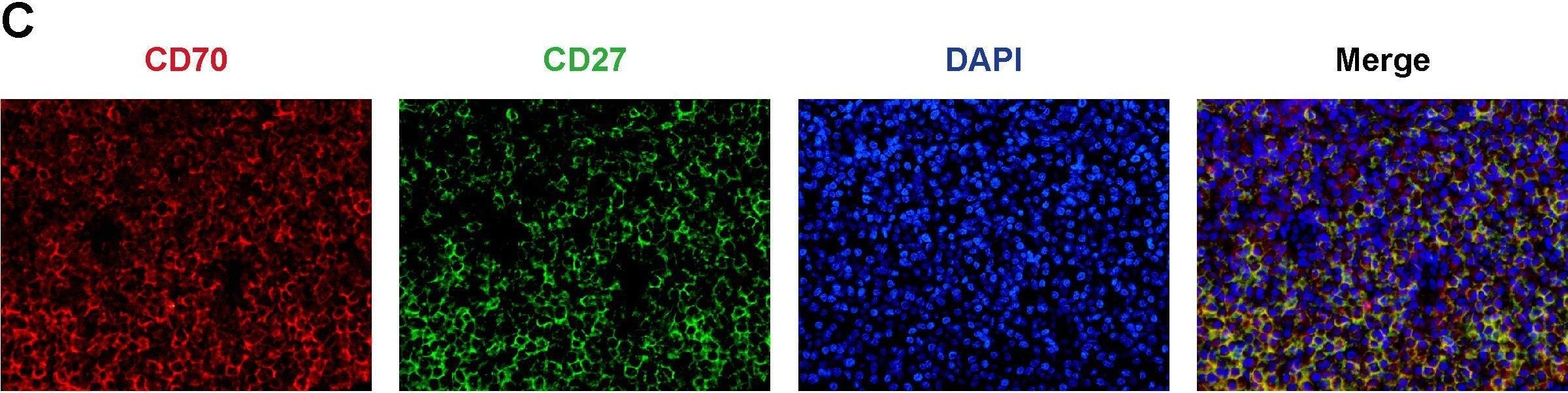Detection of CD27/TNFRSF7 by Immunohistochemistry