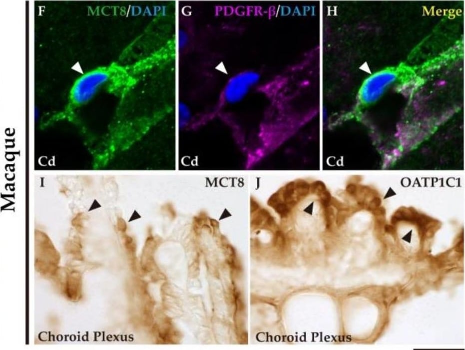 Detection of Rhesus Macaque PDGF R beta by Immunohistochemistry