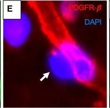 Detection of Mouse PDGF R beta by Immunohistochemistry