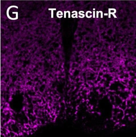 Detection of Tenascin R by Immunohistochemistry