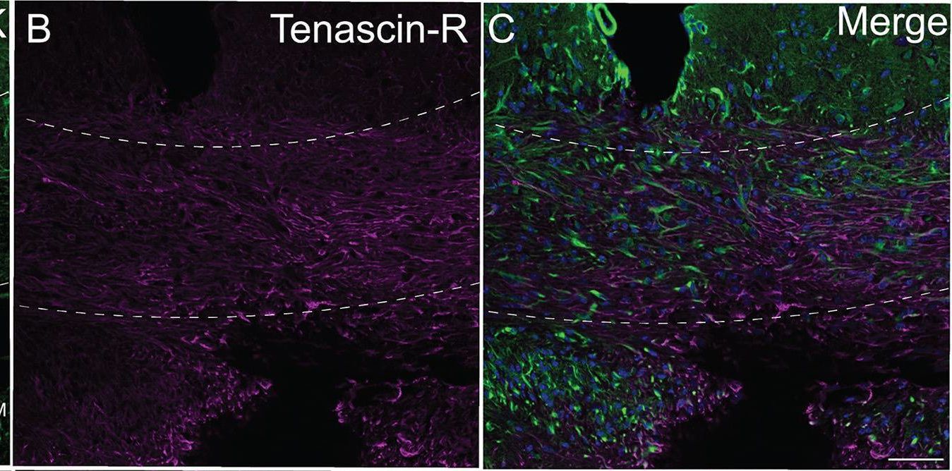 Detection of Tenascin R by Immunohistochemistry