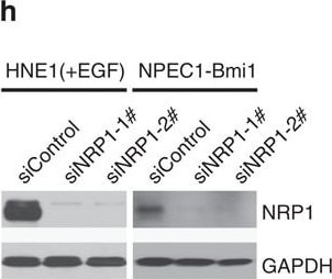 Detection of Human Neuropilin-1 by Knockdown Validated
