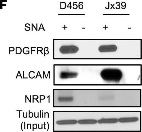 Detection of Human Neuropilin-1 by Western Blot