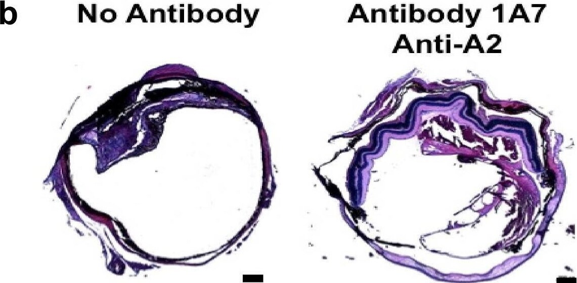 Detection of Mouse Annexin A2 by Flow Cytometry