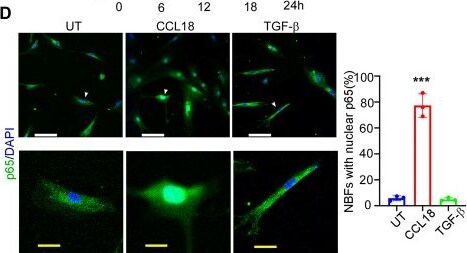 Detection of CCL18/PARC by Immunocytochemistry/ Immunofluorescence