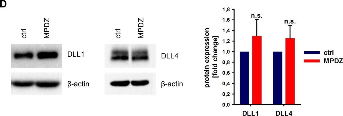 Detection of Mouse DLL1 by Western Blot