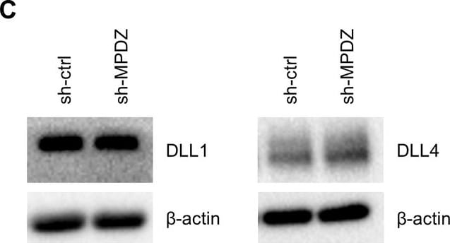 Detection of Mouse DLL1 by Western Blot