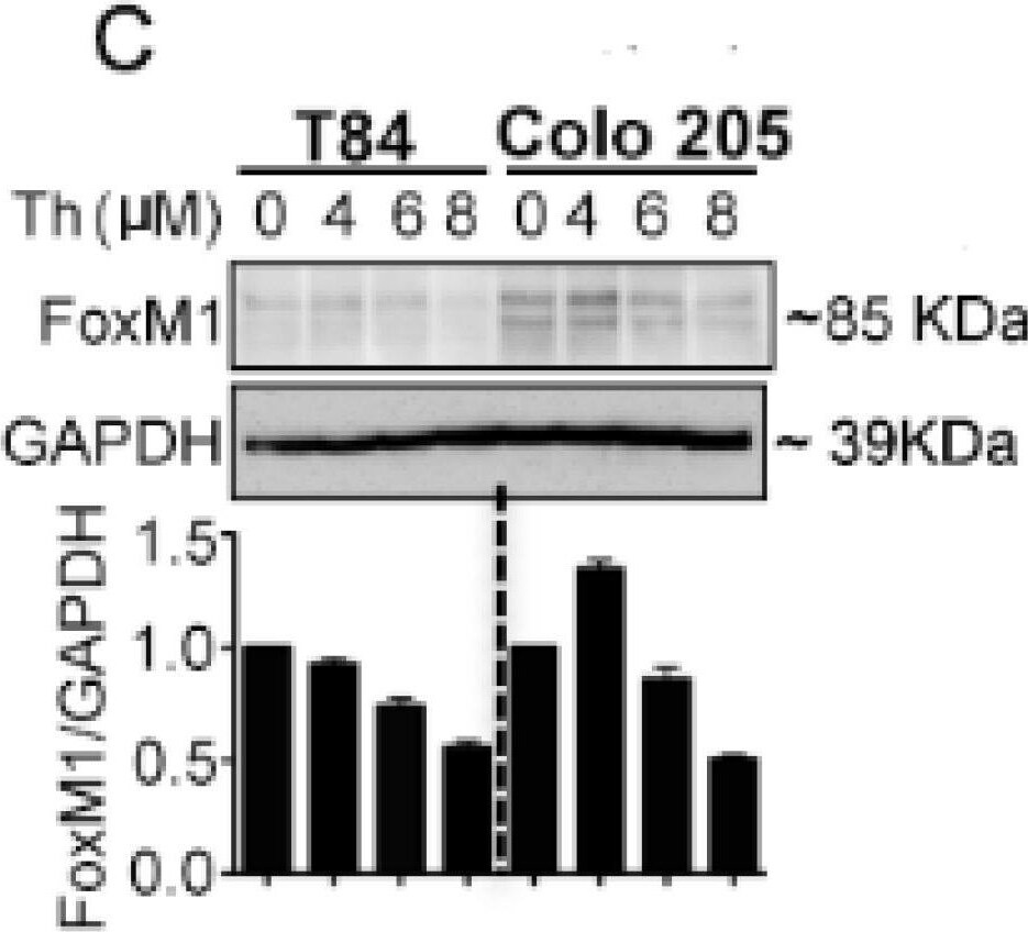 Detection of Human FoxM1 by Western Blot