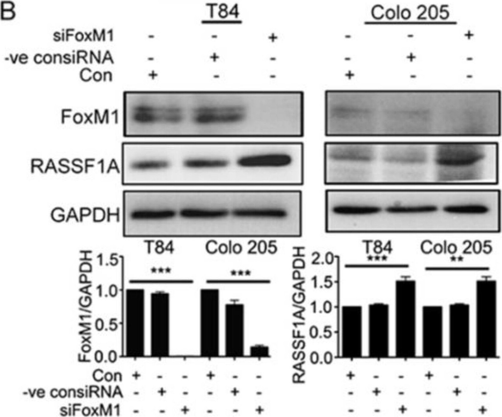 Detection of Human FoxM1 by Western Blot
