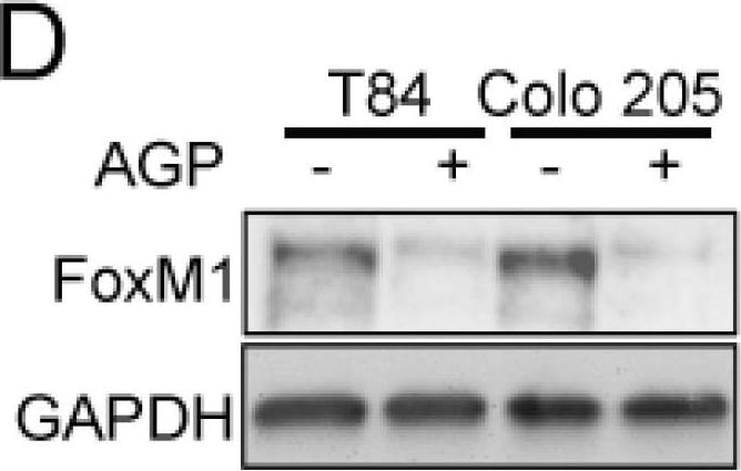 Detection of Human FoxM1 by Western Blot