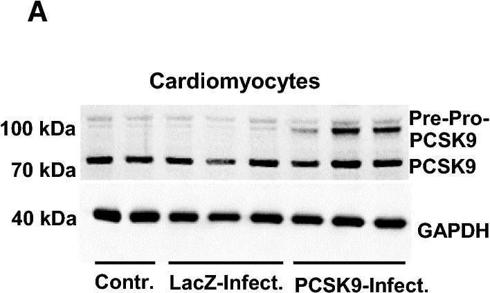 Detection of Proprotein Convertase 9/PCSK9 by Western Blot