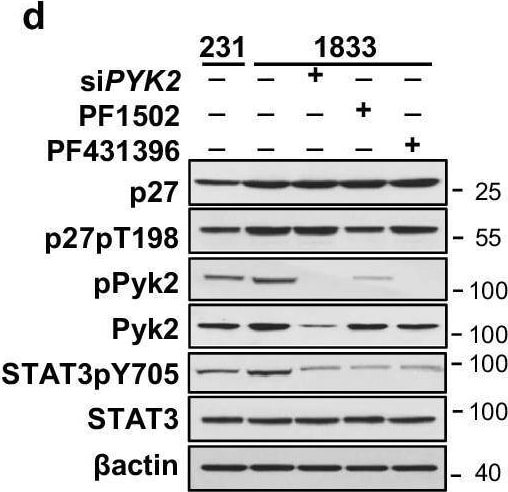 Detection of Phospho-p27/Kip1 (T198) by Western Blot