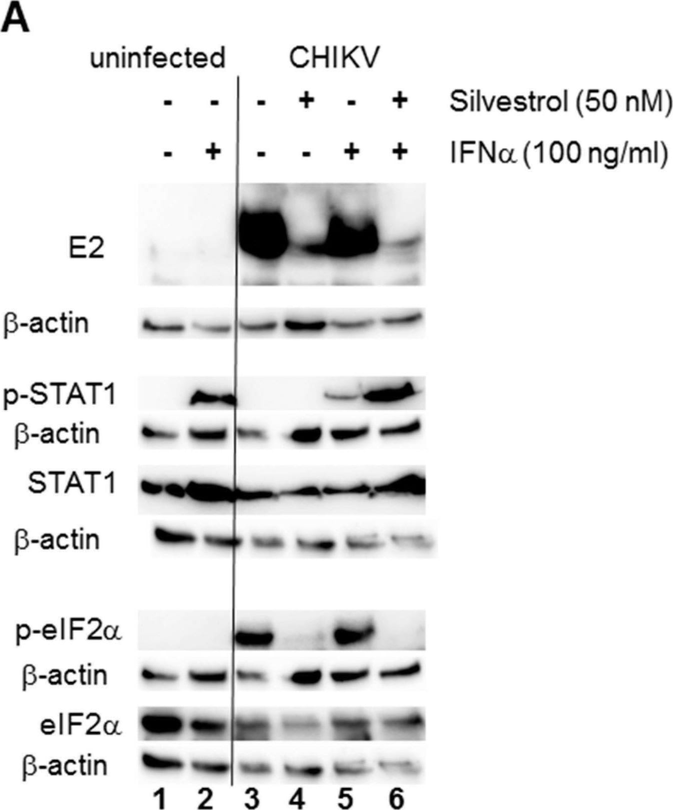 Detection of eIF2 alpha by Western Blot