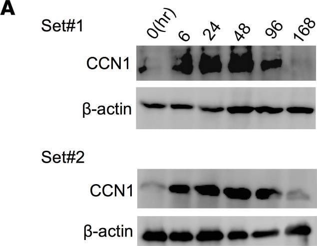 Detection of Cyr61/CCN1 by Western Blot