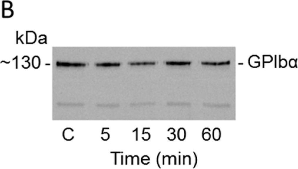 Detection of CD42b/GPIb alpha by Western Blot