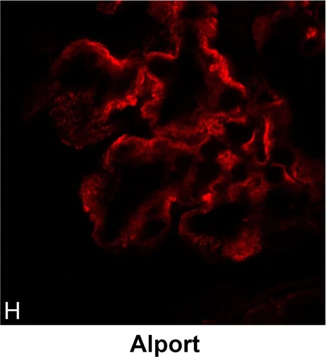 Detection of Canine Integrin alpha 8 by Immunocytochemistry/Immunofluorescence