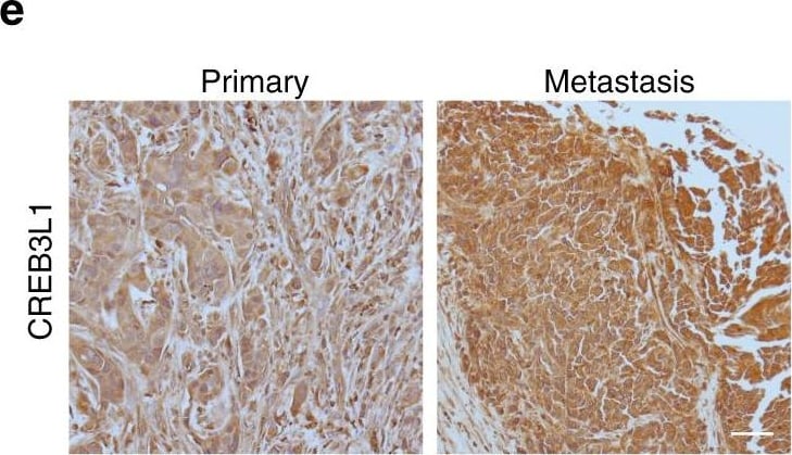 Detection of Human OASIS/CREB3L1 by Immunohistochemistry