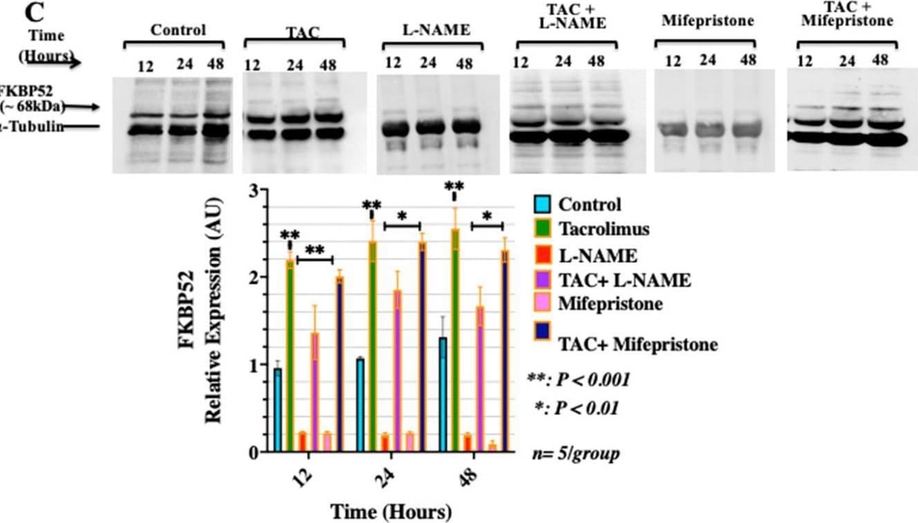 Detection of FKBP52 by Western Blot