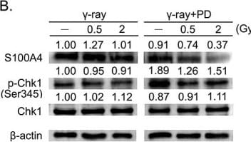 Detection of S100A4 by Western Blot