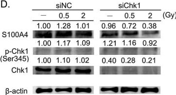 Detection of S100A4 by Western Blot